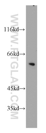 Cyclin B1 Antibody in Western Blot (WB)