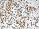 AKT Antibody in Immunohistochemistry (Paraffin) (IHC (P))