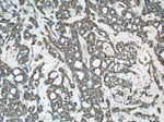 AKT Antibody in Immunohistochemistry (Paraffin) (IHC (P))