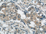 AKT Antibody in Immunohistochemistry (Paraffin) (IHC (P))