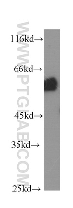 AKT Antibody in Western Blot (WB)