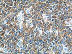 alpha Tubulin Antibody in Immunohistochemistry (Paraffin) (IHC (P))