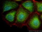 VEGFA Antibody in Immunocytochemistry (ICC/IF)