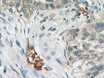 VEGFA Antibody in Immunohistochemistry (Paraffin) (IHC (P))