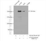 mTOR Antibody in Immunoprecipitation (IP)