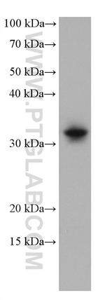 SLC31A1 Antibody in Western Blot (WB)