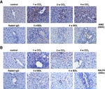 AIM2 Antibody in Immunohistochemistry (Paraffin) (IHC (P))