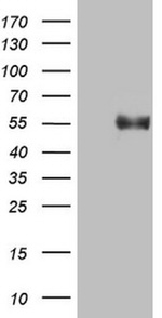 B4GALT3 Antibody in Western Blot (WB)