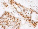 BAAT1 Antibody in Immunohistochemistry (IHC)