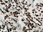 PCNA Antibody in Immunohistochemistry (Paraffin) (IHC (P))