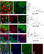 CD44 Antibody in Immunohistochemistry (IHC)