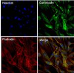 Calreticulin Antibody in Immunocytochemistry (ICC/IF)