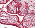 Calreticulin Antibody in Immunohistochemistry (Paraffin) (IHC (P))