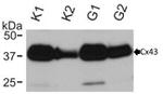 Connexin 43 Antibody in Western Blot (WB)