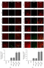 CD117 (c-Kit) Antibody in Immunohistochemistry (IHC)