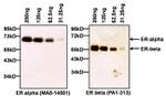 Estrogen Receptor alpha Antibody in Western Blot (WB)