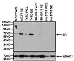 Estrogen Receptor alpha Antibody in Western Blot (WB)