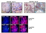 FOXP3 Antibody in Immunohistochemistry (IHC)