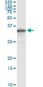 NQO1 Antibody in Immunoprecipitation (IP)