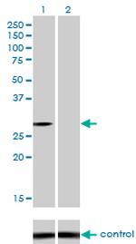 NQO1 Antibody in Western Blot (WB)