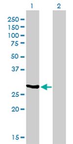 NQO1 Antibody in Western Blot (WB)