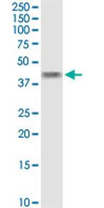 B4GALT4 Antibody in Western Blot (WB)