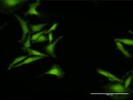 C1ORF38 Antibody in Immunocytochemistry (ICC/IF)