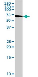 C1ORF38 Antibody in Western Blot (WB)