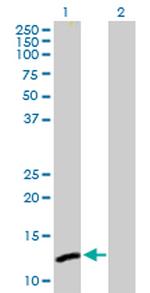 C1ORF38 Antibody in Western Blot (WB)