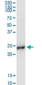 BCAP29 Antibody in Western Blot (WB)