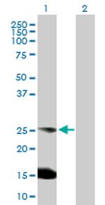 BCAP29 Antibody in Western Blot (WB)