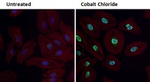 HIF1A Antibody in Immunocytochemistry (ICC/IF)