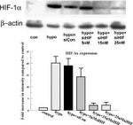 HIF1A Antibody in Western Blot (WB)