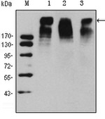 Ki-67 Antibody in Western Blot (WB)