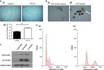 Ki-67 Antibody in Immunohistochemistry (IHC)