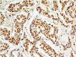 APIP Antibody in Immunohistochemistry (Paraffin) (IHC (P))