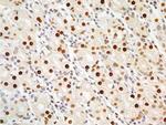 APIP Antibody in Immunohistochemistry (Paraffin) (IHC (P))