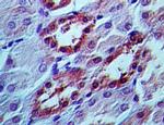 APIP Antibody in Immunohistochemistry (Paraffin) (IHC (P))