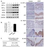 NQO1 Antibody in Immunohistochemistry (IHC)