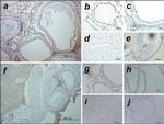 HIF1A Antibody in Immunohistochemistry (IHC)