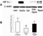 HIF1A Antibody in Western Blot (WB)