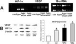 HIF1A Antibody in Western Blot (WB)