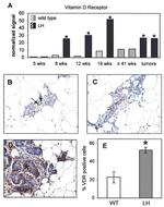 VDR Antibody in Immunohistochemistry (IHC)