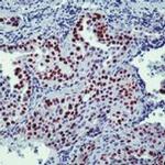 Nkx2.1 Antibody in Immunohistochemistry (Paraffin) (IHC (P))