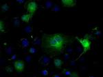 IDH1 Antibody in Immunocytochemistry (ICC/IF)