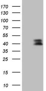 CTGF Antibody in Western Blot (WB)