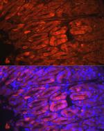 NQO1 Antibody in Immunohistochemistry (Paraffin) (IHC (P))