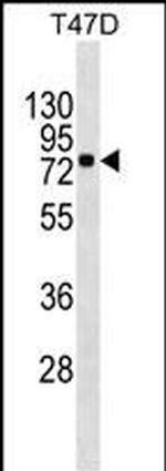 MX1 Antibody in Western Blot (WB)