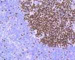 Ki-67 Antibody in Immunohistochemistry (Paraffin) (IHC (P))