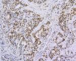 Ki-67 Antibody in Immunohistochemistry (Paraffin) (IHC (P))